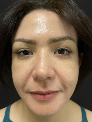 Combined Therapies after