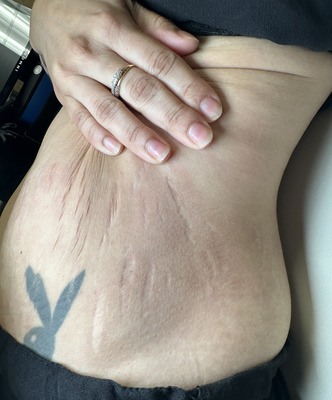Combined Therapies before