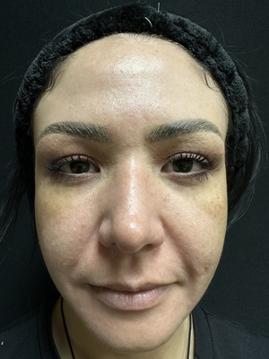 Combined Therapies before