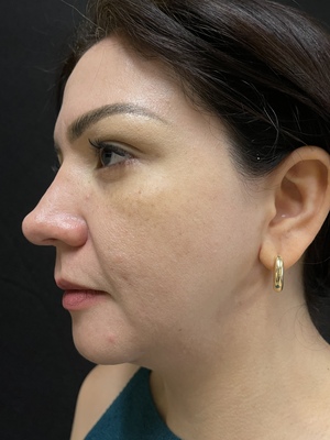 Combined Treatments before