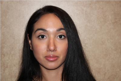 Rhinoplasty after
