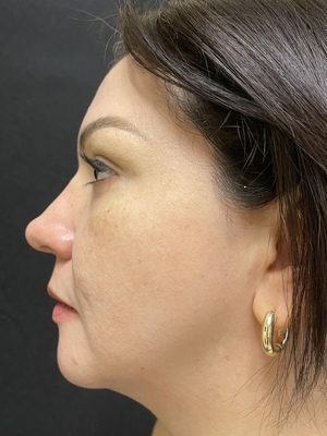 Combined Treatments after